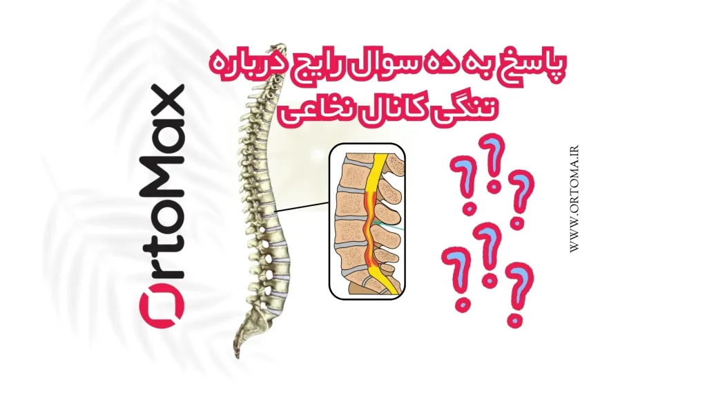 ده سوال رایج راجه به تنگی کانال نخاعی
