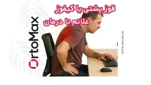 قوز پشتی یا کیفوز،علائم تا درمان