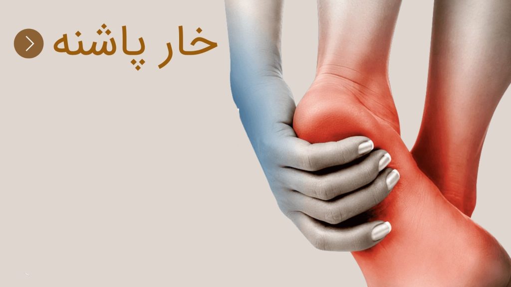خار پاشنه باعث درناک شدن پا می شود.