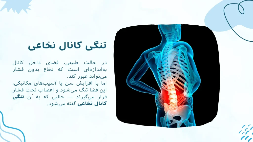 در حالت طبیعی، فضای داخل کانال به‌اندازه‌ای است که نخاع بدون فشار می‌تواند عبور کند. اما با افزایش سن یا آسیب‌های مکانیکی، این فضا تنگ می‌شود و اعصاب تحت فشار قرار می‌گیرند — حالتی که به آن تنگی کانال نخاعی گفته می‌شود.