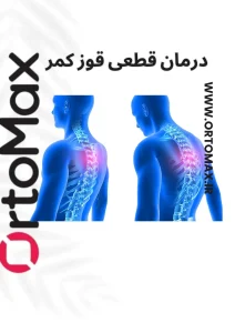 قوز کمر