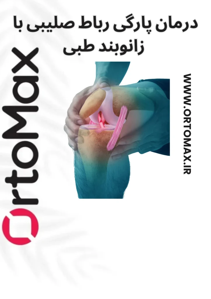 پارگی رباط صلیبی زانو