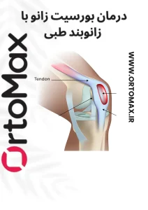 بورسیت زانو و زانوبند طبی پیشرفته