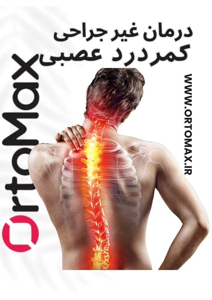 کمردرد عصبی و درمان غیر جراحی با کمربند پیشرفته طبی
