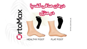 درمان قعی صلفی کف پا