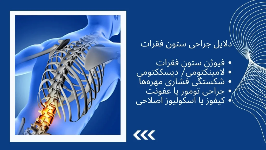 کمربند طبی پیشرفته TLSO