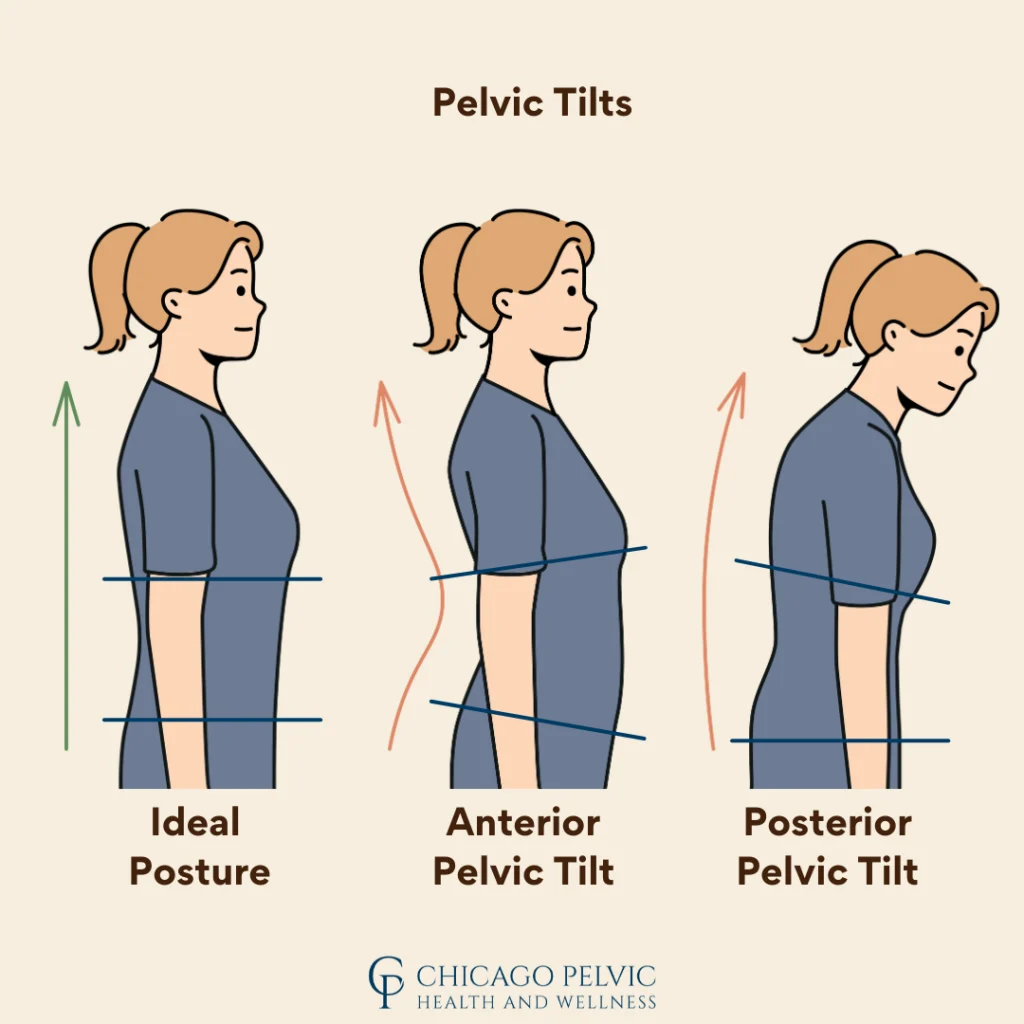 تنگی کانال نخاعی