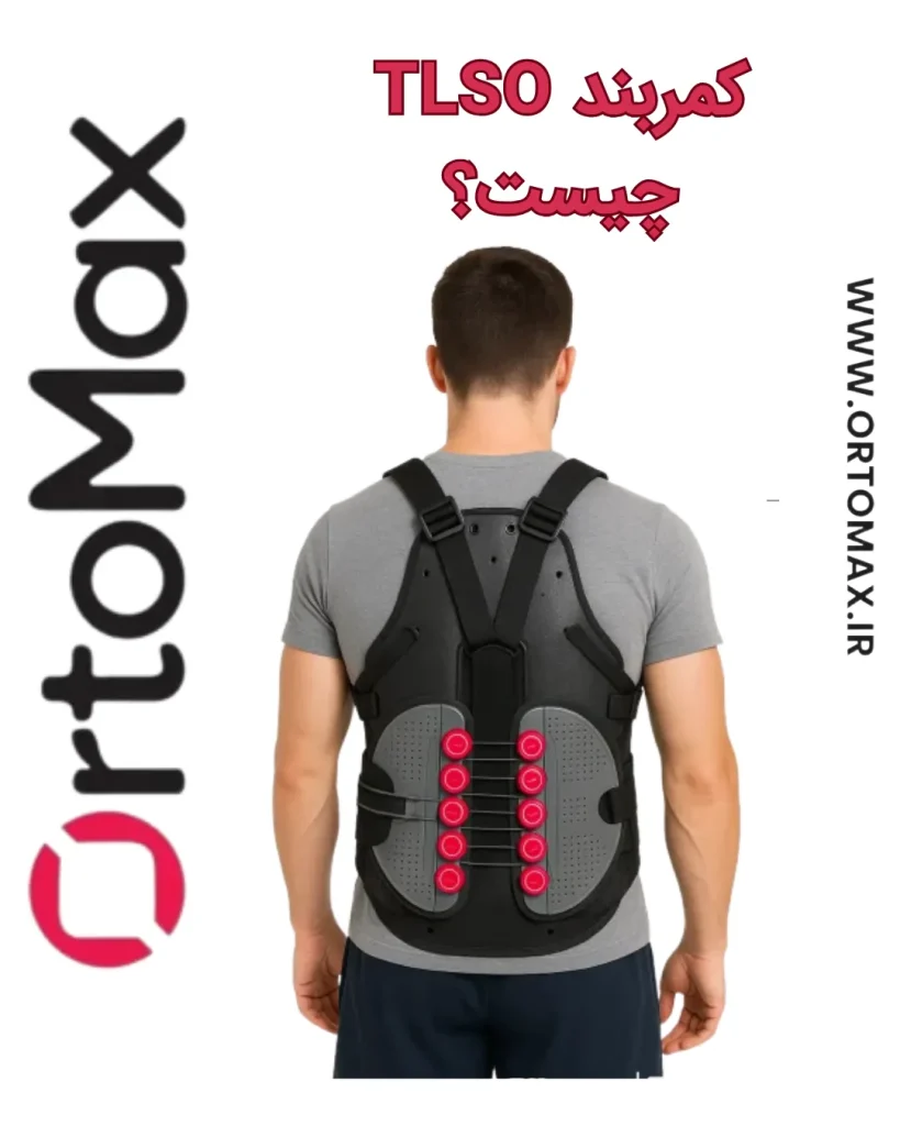 کمربند TLSO
