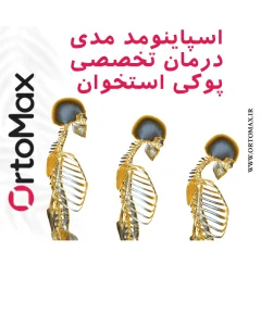 پوکی استخوان