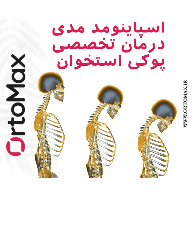 پوکی استخوان