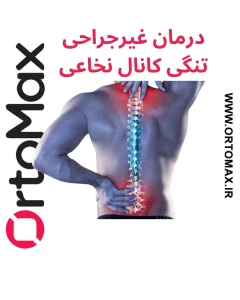 تنگی کانال نخاعی