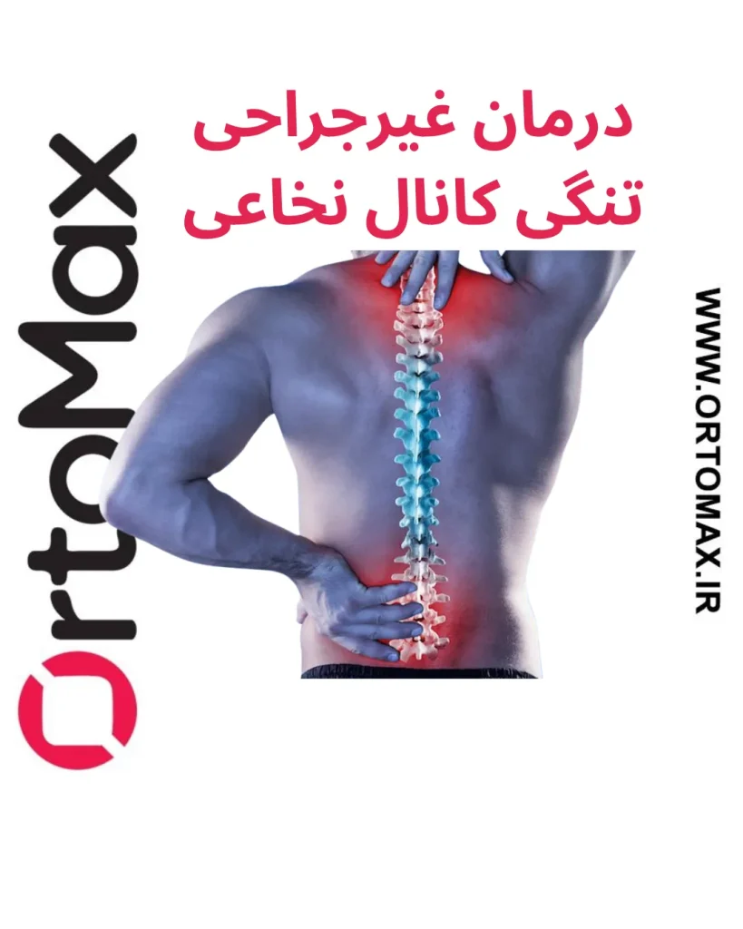 تنگی کانال نخاعی