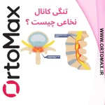 تنگی کانال نخاعی چه علائمی دارد؟